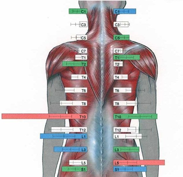 A scan showing sources of back and neck pain