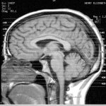 A brain scan image
